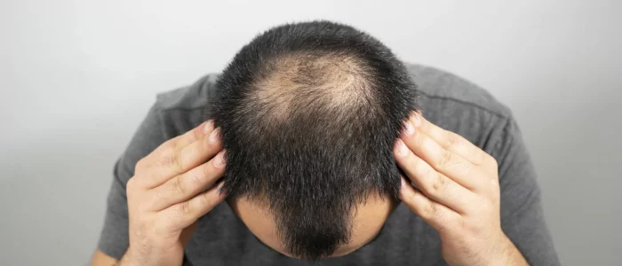 Guia definitivo de cortes de cabelo masculino