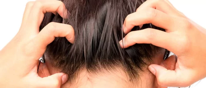 O que causa inflamação no couro cabeludo Capellux