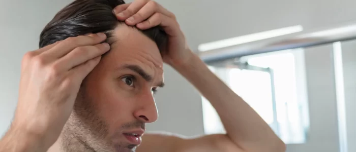 Tratamento para queda de cabelo em homens