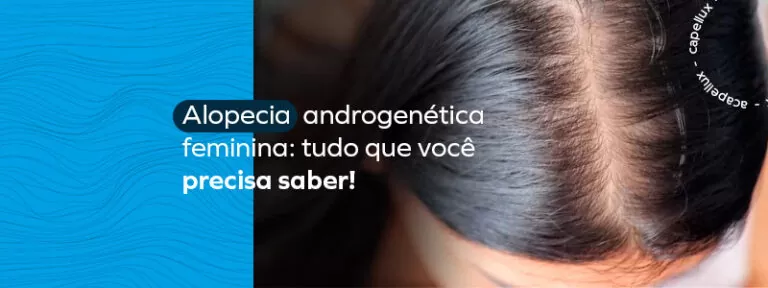 Alopecia androgenética feminina tudo que você precisa saber Capellux